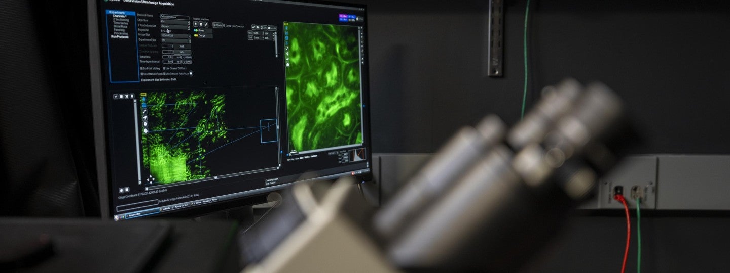 A blurred microscope in the foreground with an image displaying on a screen in the background.